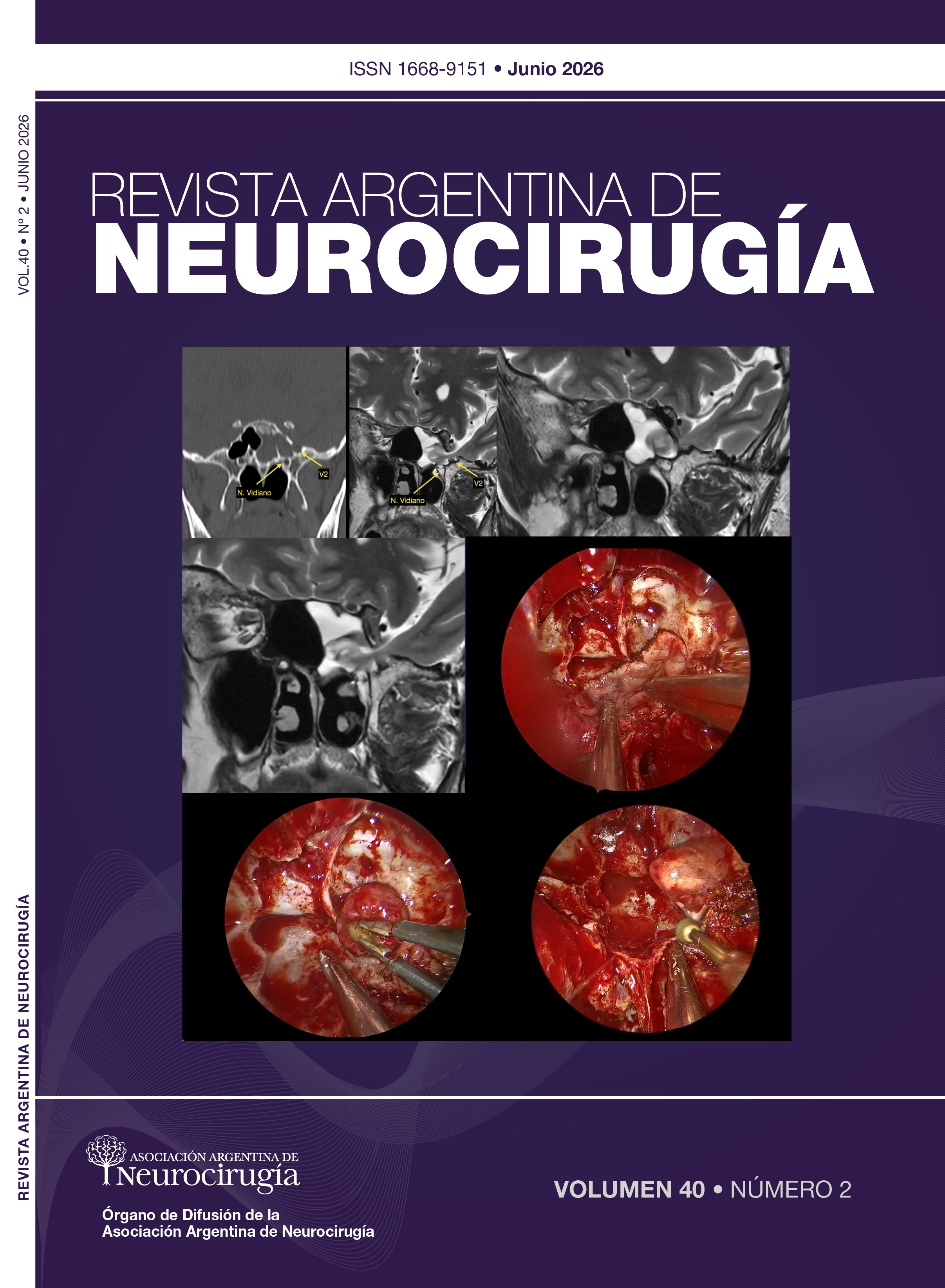 					Ver Vol. 40 Núm. 2 (2026): Revista Argentina de Neurocirugía
				